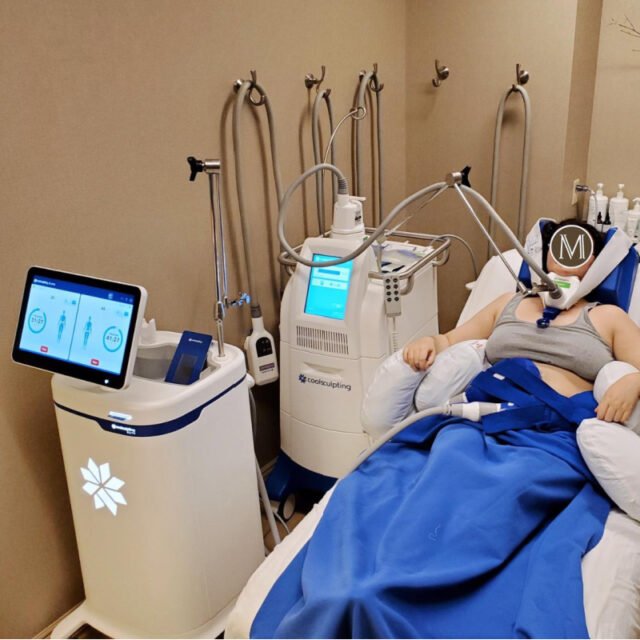 Patient getting a CoolSculpting treatment at our Eugene med spa