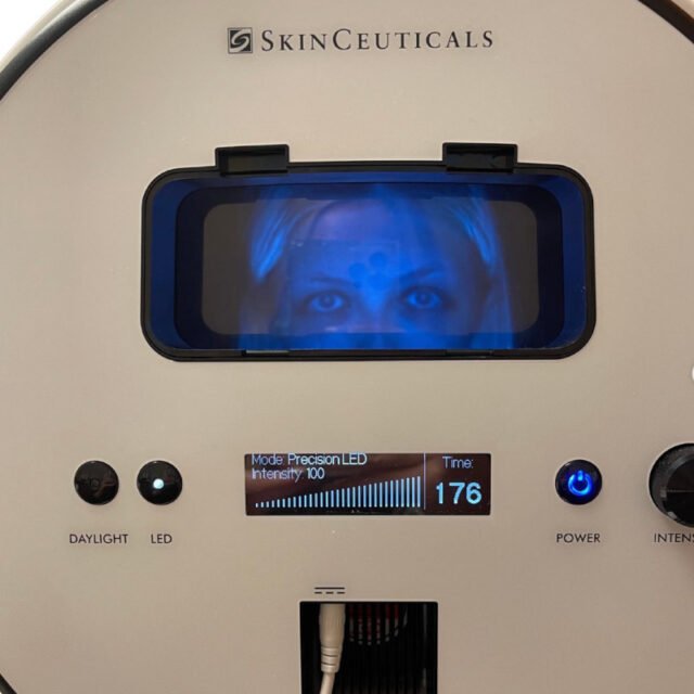 Patient during a skin evaluation with the SkinCeuticals Presicion LED skin scanner