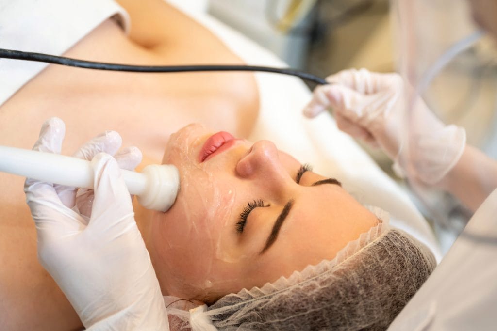 Woman getting an RF microneedling treatment at a med spa